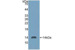 Western blot analysis of recombinant Human Thy1. (CD90 抗体  (AA 20-133))