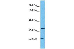 Host:  Rabbit  Target Name:  MINA  Sample Type:  Breast Tumor lysates  Antibody Dilution:  1. (MINA 抗体  (C-Term))