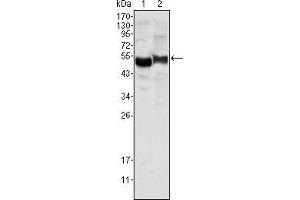 Western blot analysis using AAT mouse mAb against human plasma (1) and NIH/3T3 cell lysate (2). (AAT 抗体)