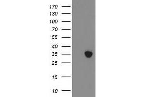 Western Blotting (WB) image for anti-Zinc Finger Protein 36, C3H Type, Homolog (Mouse) (ZFP36) antibody (ABIN2734324)