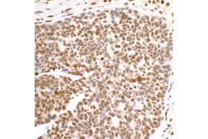 Immunohistochemistry (IHC) image for anti-DEAD (Asp-Glu-Ala-Asp) Box Polypeptide 1 (DDX1) (C-Term) antibody (ABIN7453882) (DDX1 抗体  (C-Term))