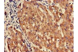 Immunohistochemistry of paraffin-embedded human liver tissue using ABIN7162462 at dilution of 1:100 (SLC1A3 抗体  (AA 7-151))