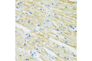 Immunohistochemistry of paraffin-embedded mouse heart using SLC19A1 antibody (ABIN6291462) at dilution of 1:100 (40x lens). (SLC19A1 抗体)