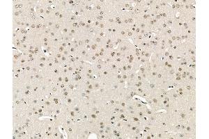 ABIN6264251 and ABIN6266824 at 1/100 staining Mouse brain tissue by IHC-P. (PKCB1 抗体  (Internal Region))