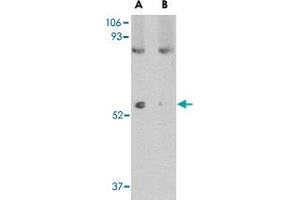 Western blot analysis of LGI1 in mouse brain tissue lysate with LGI1 polyclonal antibody  at 1 ug/mL in (A) the absence and (B) the presence of blocking peptide. (LGI1 抗体  (N-Term))
