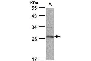 WB Image Sample (30μg whole cell lysate) A:Raji , 12% SDS PAGE antibody diluted at 1:1000 (HPGD 抗体  (C-Term))