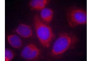 Immunofluorescence staining of methanol-fixed Hela cells using CPI17a(Ab-38) Antibody. (CPI-17 抗体)