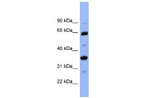 WB Suggested Anti-SERPINC1 Antibody Titration:  0. (SERPINC1 抗体  (Middle Region))