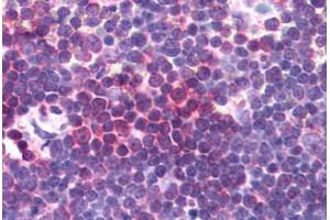 Human Thymus (formalin-fixed, paraffin-embedded) stained with AURKA antibody ABIN292641 at 10 ug/ml followed by biotinylated anti-goat IgG secondary antibody ABIN481715, alkaline phosphatase-streptavidin and chromogen. (Aurora A 抗体  (AA 394-403))