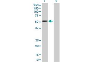 Western Blot analysis of LEPRE1 expression in transfected 293T cell line by LEPRE1 MaxPab polyclonal antibody. (LEPRE1 抗体  (AA 1-390))