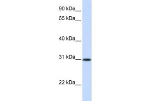 WB Suggested Anti-ATF5 Antibody Titration: 0. (ATF5 抗体  (Middle Region))