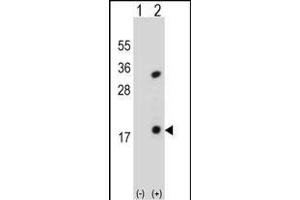 Western blot analysis of PLA2G1B (arrow) using rabbit polyclonal PLA2G1B Antibody (C-term) (ABIN651072 and ABIN2840059). (PLA2G1B 抗体  (C-Term))