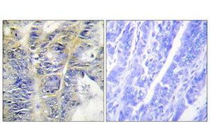 Immunohistochemistry (IHC) image for anti-Collagen, Type IV, alpha 5 (COL4A5) (N-Term) antibody (ABIN1850286) (COL4a5 抗体  (N-Term))