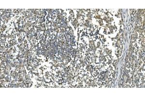 IHC analysis of LSM7 using anti-LSM7 antibody (ABIN7598937). (LSM7 抗体  (AA 1-103))