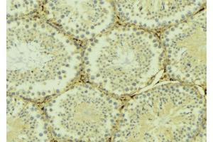 ABIN6268960 at 1/100 staining Mouse testis tissue by IHC-P. (Stathmin 1 抗体  (N-Term))