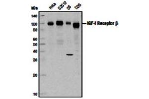 Image no. 3 for anti-Insulin-Like Growth Factor 1 Receptor (IGF1R) (C-Term) antibody (ABIN228595) (IGF1R 抗体  (C-Term))