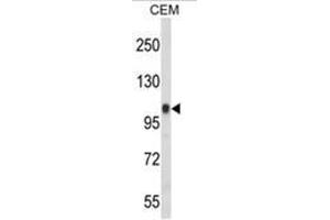 Western blot analysis of ITGB3 Antibody (Integrin beta 3 抗体  (C-Term))