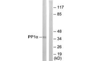 Western Blotting (WB) image for anti-Protein Phosphatase 1, Catalytic Subunit, alpha Isoform (PPP1CA) (AA 281-330), (pThr320) antibody (ABIN482082) (PPP1CA 抗体  (pThr320))