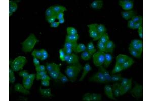 Immunofluorescence staining of MCF-7 cells with ABIN7149497 at 1:133, counter-stained with DAPI. (DAZAP2 抗体  (AA 1-168))