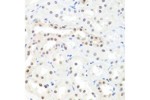 Immunohistochemistry of paraffin-embedded rat kidney using HNRNPCL1 antibody (ABIN5995850) at dilution of 1/100 (40x lens). (HNRNPCL1 抗体)