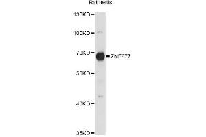 Western blot analysis of extracts of rat testis, using ZNF677 antibody. (ZNF677 抗体)