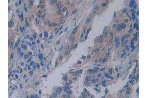 Immunohistochemistry (IHC) image for anti-Pancreas Specific Transcription Factor, 1a (PTF1A) (AA 177-328) antibody (ABIN7435103)