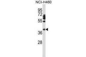 Western Blotting (WB) image for anti-Forkhead Box D1 (FOXD1) antibody (ABIN2997954) (FOXD1 抗体)
