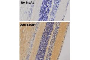 Immunohistochemistry (IHC) image for anti-STIP1 Homology and U-Box Containing Protein 1 (STUB1) antibody (ABIN6254206) (STUB1 抗体)
