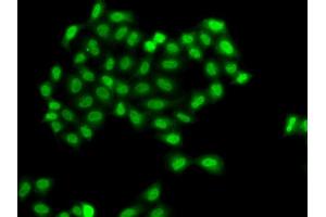 Immunofluorescence analysis of A549 cells using PHF11 antibody. (PHF11 抗体)