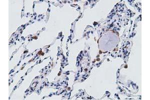Immunohistochemical staining of paraffin-embedded Human lung tissue using anti-PECR mouse monoclonal antibody. (PECR 抗体)