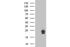 Image no. 1 for anti-Transmembrane Emp24 Protein Transport Domain Containing 1 (TMED1) antibody (ABIN1501414) (TMED1 抗体)