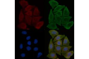 ABIN6258319 and ABIN6275775 staining Hela cells(30 min of UV treatment) by IF/ICC. (IFIT5 抗体  (Internal Region))