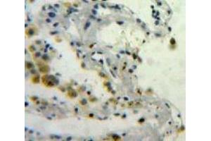 IHC-P analysis of Lung tissue, with DAB staining. (SPARC 抗体  (AA 18-301))