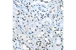 Immunohistochemistry (IHC) image for anti-MYST Histone Acetyltransferase 2 (MYST2) (AA 55-193) antibody (ABIN6142689)