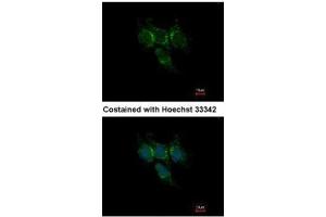 ICC/IF Image Immunofluorescence analysis of methanol-fixed Hep3B, using GSTA1, antibody at 1:500 dilution. (GSTA1 抗体)