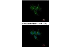 ICC/IF Image Immunofluorescence analysis of methanol-fixed Hep3B, using GSTA1, antibody at 1:500 dilution.
