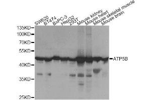 Western blot analysis of extracts of various cell lines, using ATP5B Antibody.