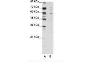Image no. 1 for anti-Core-binding Factor, Runt Domain, alpha Subunit 2, Translocated To, 3 (CBFA2T3) (N-Term) antibody (ABIN203203) (CBFA2T3 抗体  (N-Term))