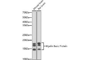 Western blot analysis of extracts of various cell lines, using Myelin Basic Protein antibody (ABIN3022348, ABIN3022349, ABIN3022350 and ABIN6218754) at 1:1000 dilution. (MBP 抗体  (AA 1-197))