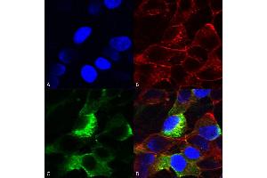 Immunocytochemistry/Immunofluorescence analysis using Mouse Anti-Nav beta3 Monoclonal Antibody, Clone S396-29 (ABIN2485575). (SCN3B 抗体  (AA 1-215))