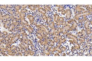 Detection of IL11Ra in Mouse Kidney Tissue using Polyclonal Antibody to Interleukin 11 Receptor Alpha (IL11Ra)