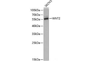 Western blot analysis of extracts of SKOV3 cells using WNT2 Polyclonal Antibody at dilution of 1:1000. (WNT2 抗体)