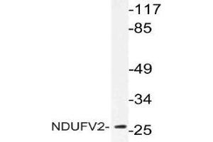 Western blot (WB) analysis of NDUFV2 antibody in extracts from Jurkat cells. (NDUFV2 抗体)