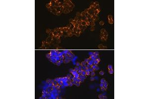 Immunofluorescence analysis of MCF-7 cells using NMD Rabbit mAb (ABIN7267417) at dilution of 1:100 (40x lens). (GRIN1/NMDAR1 抗体)