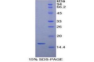 SDS-PAGE (SDS) image for Brain-Derived Neurotrophic Factor (BDNF) (AA 117-248) protein (His tag) (ABIN1880085) (BDNF Protein (AA 117-248) (His tag))