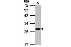 WB Image Sample (30 ug of whole cell lysate) A: IMR32 12% SDS PAGE antibody diluted at 1:500 (ARHGDIA 抗体)