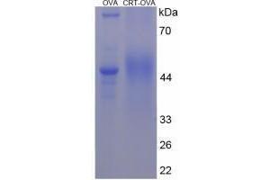 Image no. 1 for Calreticulin (CALR) peptide (Ovalbumin) (ABIN5666115)