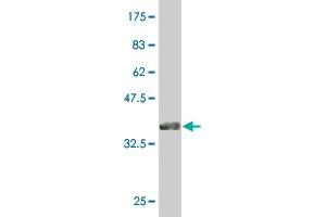 Western Blotting (WB) image for anti-Cullin-Associated and Neddylation-Dissociated 1 (CAND1) (AA 1-100) antibody (ABIN527718)