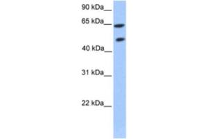 Western Blotting (WB) image for anti-Zinc Finger Protein 449 (ZNF449) antibody (ABIN2460260) (ZNF449 抗体)