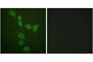 Immunofluorescence analysis of A549 cells, using PKA alpha/beta CAT (Ab-197) Antibody. (PKA alpha/beta Cat (AA 166-215) 抗体)